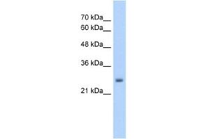 WB Suggested Anti-NELF Antibody Titration:  5. (NMDA Receptor Synaptonuclear Signaling and Neuronal Migration Factor (NSMF) (Middle Region) antibody)