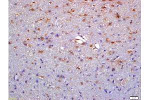 Formalin-fixed and paraffin embedded rat brain labeled with Anti-NTR1/Neurotensin Receptor 1 Polyclonal Antibody, Unconjugated (ABIN1386649) at 1:200 followed by conjugation to the secondary antibody and DAB staining (NTSR1 antibody  (AA 188-290))