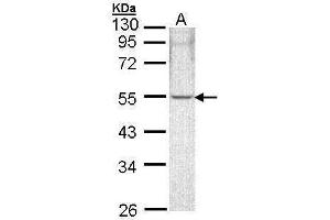 WB Image Sample (30 ug of whole cell lysate) A: A431 , 10% SDS PAGE antibody diluted at 1:1000 (ARHGAP1 antibody)