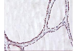 Immunohistochemical staining of paraffin-embedded Human thyroid tissue using anti-HES1 mouse monoclonal antibody. (HES1 antibody)