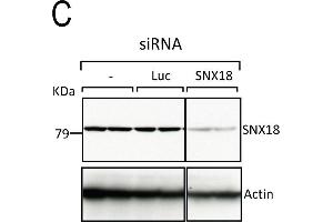 SNX9 depletion phenocopies CHC depletion during mitosis. (SNX18 antibody  (C-Term))