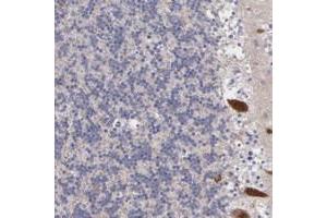Immunohistochemical staining of human cerebellum with NPTXR polyclonal antibody  shows strong cytoplasmic positivity in purkinje cells at 1:50-1:200 dilution. (NPTXR antibody)