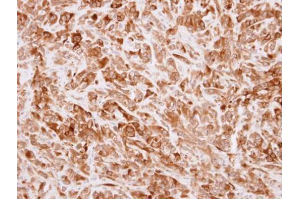 TRAIP antibody