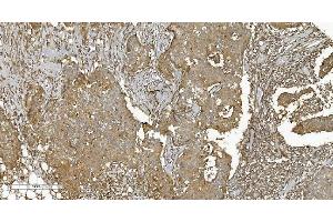 IHC analysis of PLTP using anti-PLTP antibody (ABIN7600346). (PLTP antibody  (AA 18-470))