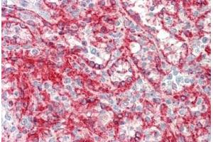Human Spleen: Formalin-Fixed, Paraffin-Embedded (FFPE) (HLA-A antibody  (AA 70-99))