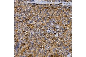 Immunohistochemistry of paraffin-embedded rat spleen using CD26/DPP4 Rabbit pAb (ABIN6130064, ABIN6139794, ABIN6139795 and ABIN6218546) at dilution of 1:25 (40x lens). (DPP4 antibody  (AA 29-280))