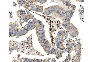 IHC analysis of LPP using anti LPP antibody (ABIN7602831). (LPP antibody  (C-Term))
