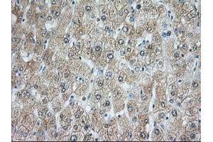 Immunohistochemical staining of paraffin-embedded Human prostate tissue using anti-RAB17 mouse monoclonal antibody.
