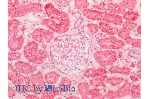ABIN5539538 (5µg/ml) staining of paraffin embedded Human Kidney.