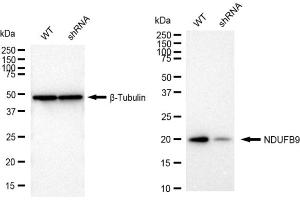 Western blotting analysis using NDUFB9 antibody (ABIN7799553).