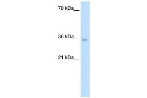 ATIC antibody used at 5 ug/ml to detect target protein. (ATIC antibody  (Middle Region))