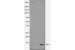 Western blot analysis of SDF 1 expression in HepG2 cells,The lane on the left is treated with the antigen-specific peptide. (CXCL12 antibody  (C-Term))