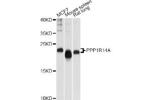 Western blot analysis of extracts of various cell lines, using PPP1R14A antibody (ABIN6003858) at 1/1000 dilution. (CPI-17 antibody)