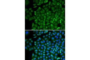 Immunofluorescence (IF) image for anti-Selenium Binding Protein 1 (SELENBP1) (AA 243-472) antibody (ABIN1513508) (SELENBP1 antibody  (AA 243-472))