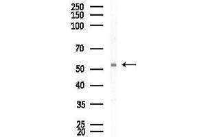 anti-Armadillo Repeat Containing 6 (ARMC6) (C-Term) antibody