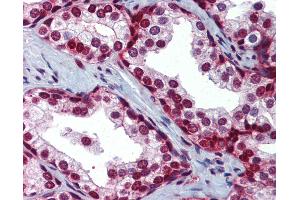 Anti-SLC35A5 antibody IHC of human prostate. (SLC35A5 antibody  (AA 36-85))