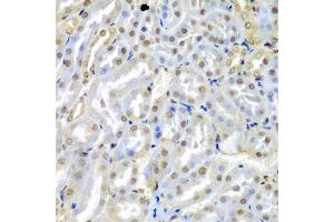 Immunohistochemistry of paraffin-embedded mouse kidney using TUSC2 antibody at dilution of 1:200 (40x lens). (TUSC2 antibody)