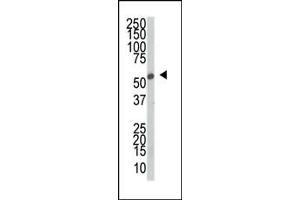 Western blot analysis of anti-SRPK2 Pab (ABIN391795 and ABIN2841650) in mouse thymus tissue lysate. (SRPK2 antibody  (C-Term))