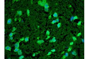 Immunohistochemistry analysis using Rabbit Anti-HSP22 Polyclonal Antibody .