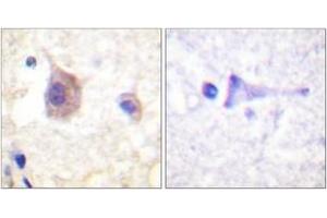 Immunohistochemistry analysis of paraffin-embedded human brain, using PKD1/PKC mu (Phospho-Tyr463) Antibody. (PKC mu antibody  (pTyr463))