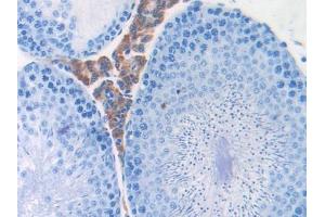 Immunohistochemistry (IHC) image for anti-Cytochrome P450, Family 2, Subfamily E, Polypeptide 1 (CYP2E1) (AA 126-309) antibody (ABIN1174041)