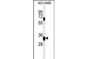 Western blot analysis of KCTD1 Antibody (C-term) (ABIN651146 and ABIN2840098) in NCI- cell line lysates (35 μg/lane).