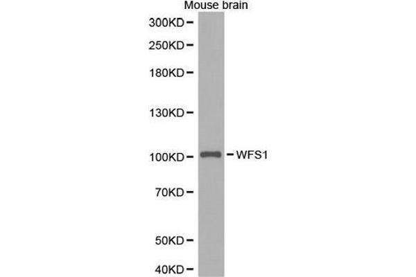 WFS1 anticorps  (AA 1-285)