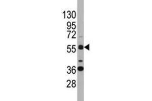 Western blot analysis of SOX9 antibody and K562 lysate. (SOX9 antibody  (AA 41-70))