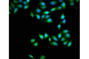 Immunofluorescence staining of Hela cells with ABIN7150152 at 1:133, counter-stained with DAPI. (APOBEC3D antibody  (AA 250-371))