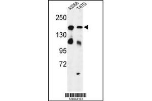Western blot analysis of HDLBP Antibody in A2058, T47D cell line lysates (35ug/lane) (HDLBP antibody  (AA 764-791))