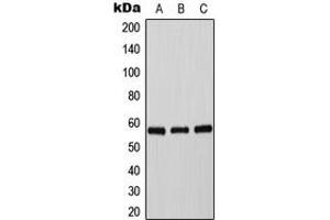 Western blot analysis of Tyrosine Hydroxylase (pS71) expression in HepG2 UV-treated (A), mouse brain (B), PC12 (C) whole cell lysates. (Tyrosine Hydroxylase antibody  (N-Term, pSer71))