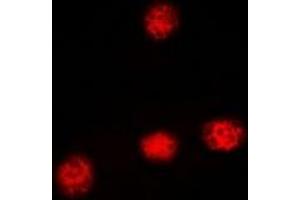Immunofluorescent analysis of XRCC3 staining in HeLa cells. (XRCC3 antibody)