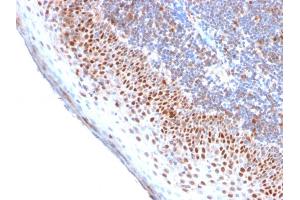 Formalin-fixed, paraffin-embedded human Tonsil stained with MCM7 Recombinant Rabbit Monoclonal Antibody (MCM7/2756R). (Recombinant MCM7 antibody  (AA 195-319))