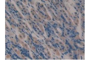 Detection of LTF in Mouse Stomach Tissue using Polyclonal Antibody to Lactoferrin (LTF) (Lactoferrin antibody  (AA 63-193))