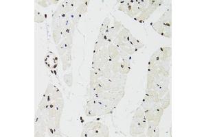 Immunohistochemistry of paraffin-embedded mouse heart using SFPQ antibody (ABIN5970351) at dilution of 1/100 (40x lens). (SFPQ antibody)