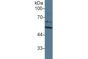 Detection of ACHE in Human HepG2 cell lysate using Polyclonal Antibody to Acetylcholinesterase (ACHE) (Acetylcholinesterase antibody  (AA 157-332))