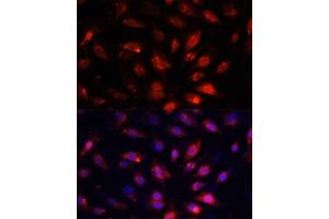 Immunofluorescence (IF) image for anti-Enolase 3 (Beta, Muscle) (ENO3) (AA 1-190) antibody (ABIN7266960)