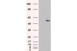Image no. 3 for anti-Keratin 8 (KRT8) (AA 91-381) antibody (ABIN1491712) (KRT8 antibody  (AA 91-381))