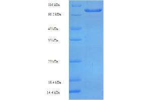 ZNF165 Protein (AA 1-485, full length) (His-SUMO Tag)