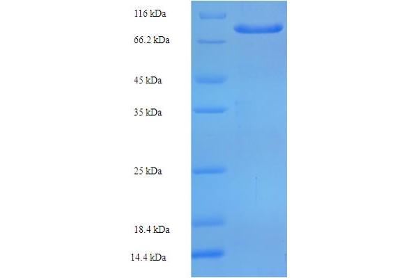 ZNF165 Protein (AA 1-485, full length) (His-SUMO Tag)