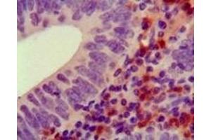 Immunohistochemistry (IHC) image for anti-Hemopoietic Cell Kinase (HCK) (truncated) antibody (ABIN2464063) (HCK antibody  (truncated))