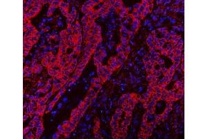 IF analysis of CLASP1 using anti-CLASP1 antibody (ABIN7599144). (CLASP1 antibody  (AA 1-243))
