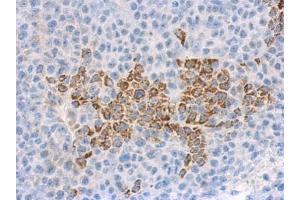 IHC-P Image Immunohistochemical analysis of paraffin-embedded hela xenograft, using IL1F9 antibody, antibody at 1:500 dilution. (IL1F9 antibody  (C-Term))