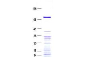 Validation with Western Blot (SSX2IP Protein (His tag))