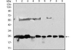 Western blot analysis using CSNK2B mouse mAb against Hela (1), Jurkat (2), K562 (3), HepG2 (4), C6 (5), SK-N-SH (6), NTERA-2 (7), MCF-7 (8), NIH/3T3 (9) cell lysate. (CSNK2B antibody  (AA 1-215))