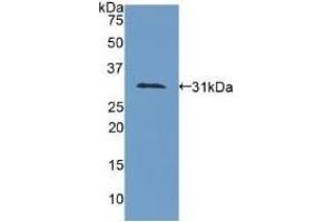 Detection of Recombinant COL4a1, Human using Polyclonal Antibody to Collagen Type IV Alpha 1 (COL4a1) (COL4A1 antibody  (AA 1444-1669))