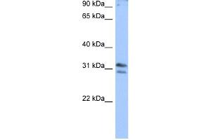 WB Suggested Anti-RG9MTD3 Antibody Titration:  0. (RG9MTD3 antibody  (N-Term))