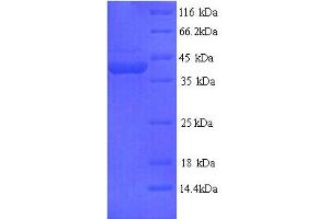 SDS-PAGE (SDS) image for Flightless I Homolog (FLII) (AA 495-827), (partial) protein (His tag) (ABIN5714500)