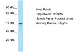 Image no. 1 for anti-Olfactory Receptor 52A5 (OR52A5) (C-Term) antibody (ABIN6749903) (OR52A5 antibody  (C-Term))