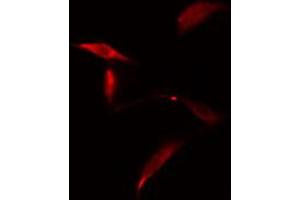 ABIN6274829 staining A549 cells by IF/ICC. (AKR1E2 antibody  (Internal Region))